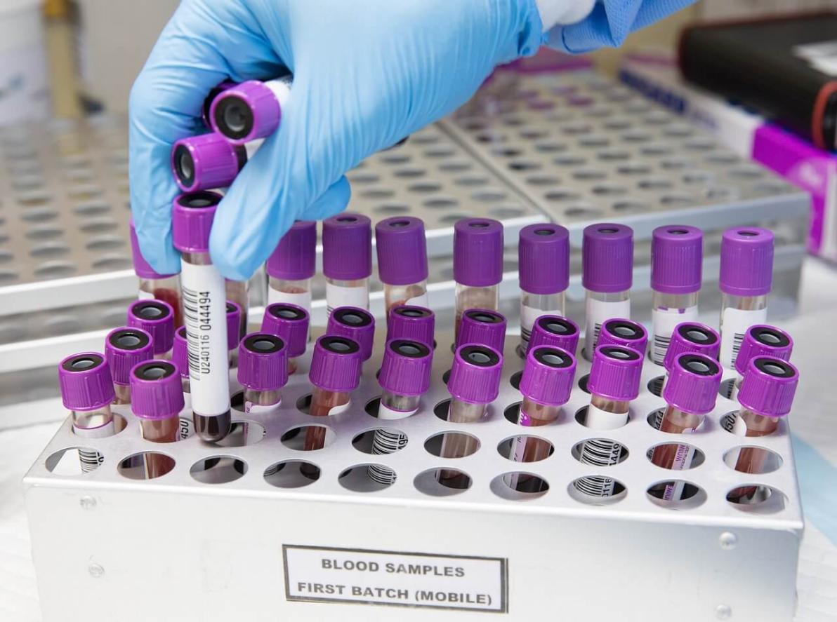 DAX-Korrektur! BioTech Im Übernahme-Modus! BioNTech, CureVac, Pfizer, Vidac Pharma und Kraft Heinz im Fokus DAX-Korrektur! BioTech Im Übernahme-Modus! BioNTech, CureVac, Pfizer, Vidac Pharma und Kraft Heinz im Fokus