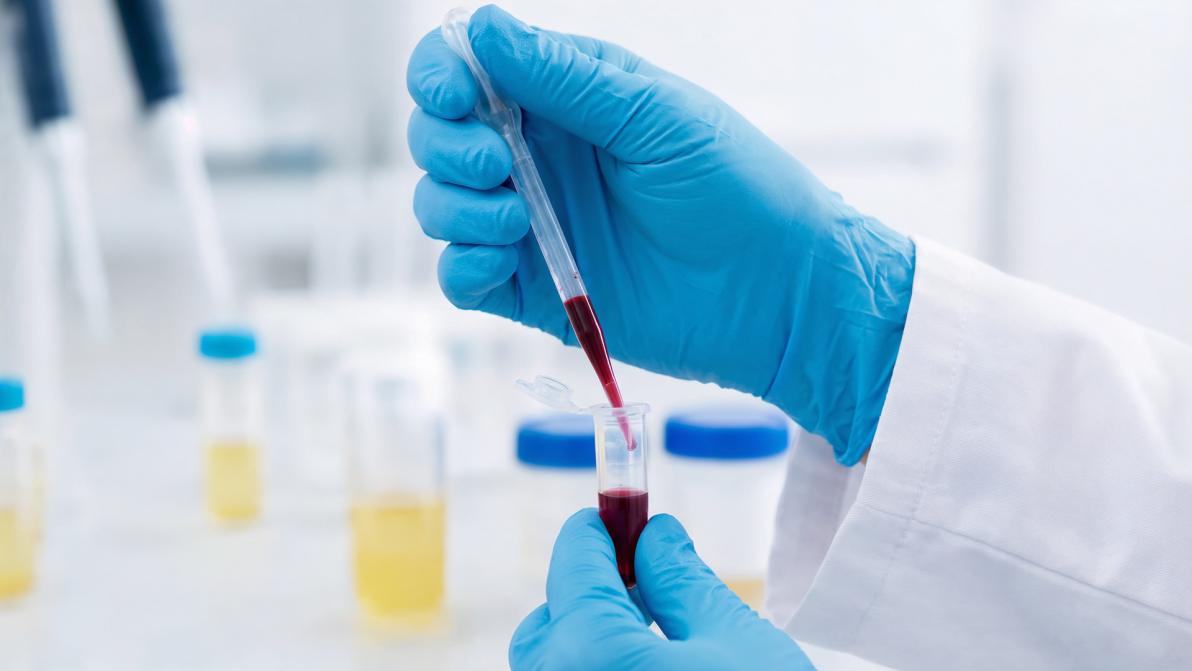 Biotech- und Life-Science-Boom: Evotec, BioNxt Solutions und Merck – wo lohnt sich ein Investment?