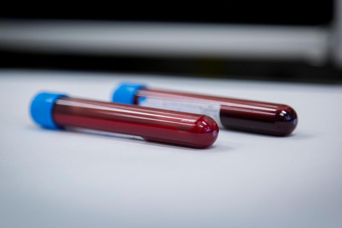 Vom Hidden Champion zum Übernahmeziel: Warum diese Schmelzfilm-Revolution Anlegern ein Kursfeuerwerk bescheren könnte!