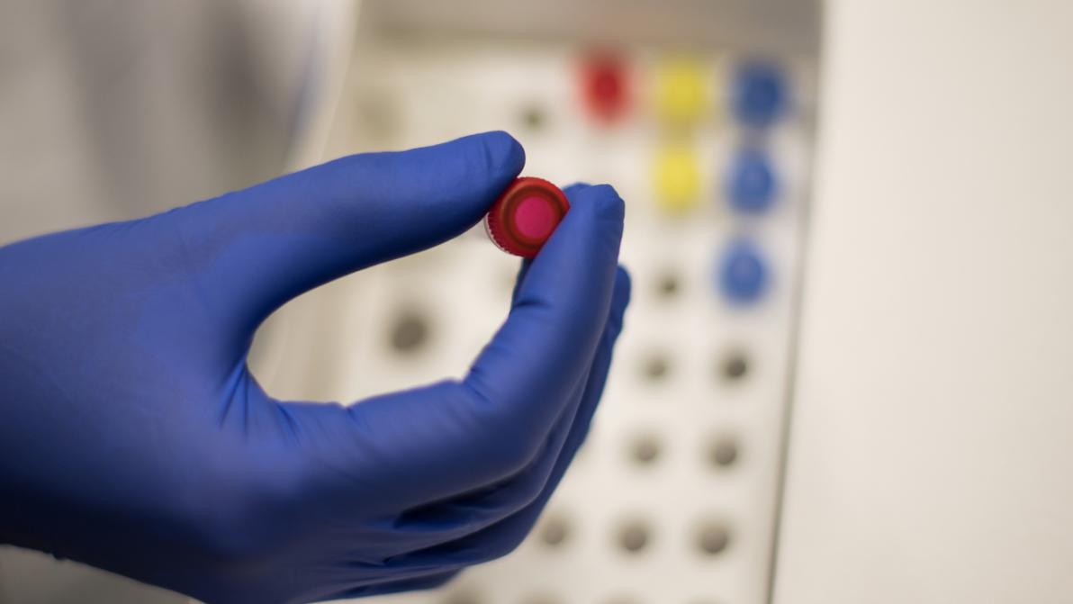 "Seltene Gelegenheit" - Schon jetzt zuschlagen? Warum BofA diesen Biotech-Geheimtipp für 2026 empfiehlt