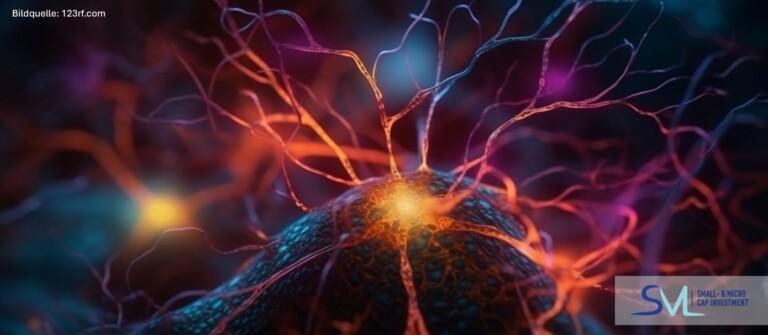 NurExone Biologic rückt mit validierten Exosomen-Produktionsdaten näher an die Klinik